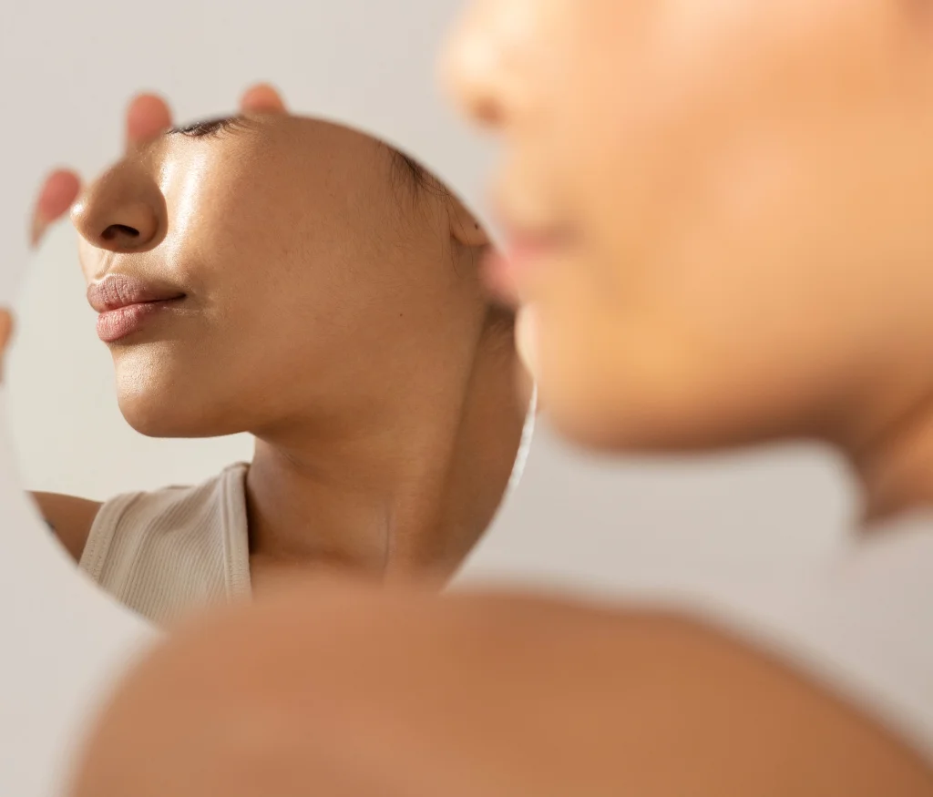 Lip Lift Surgery Lebanon – Subnasal Bullhorn Lip Lift Beirut