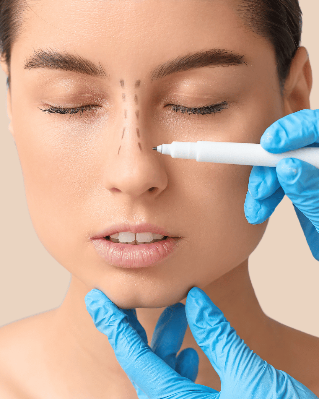 Primary Rhinoplasty Lebanon – Nose Job Beirut at The Face Institute