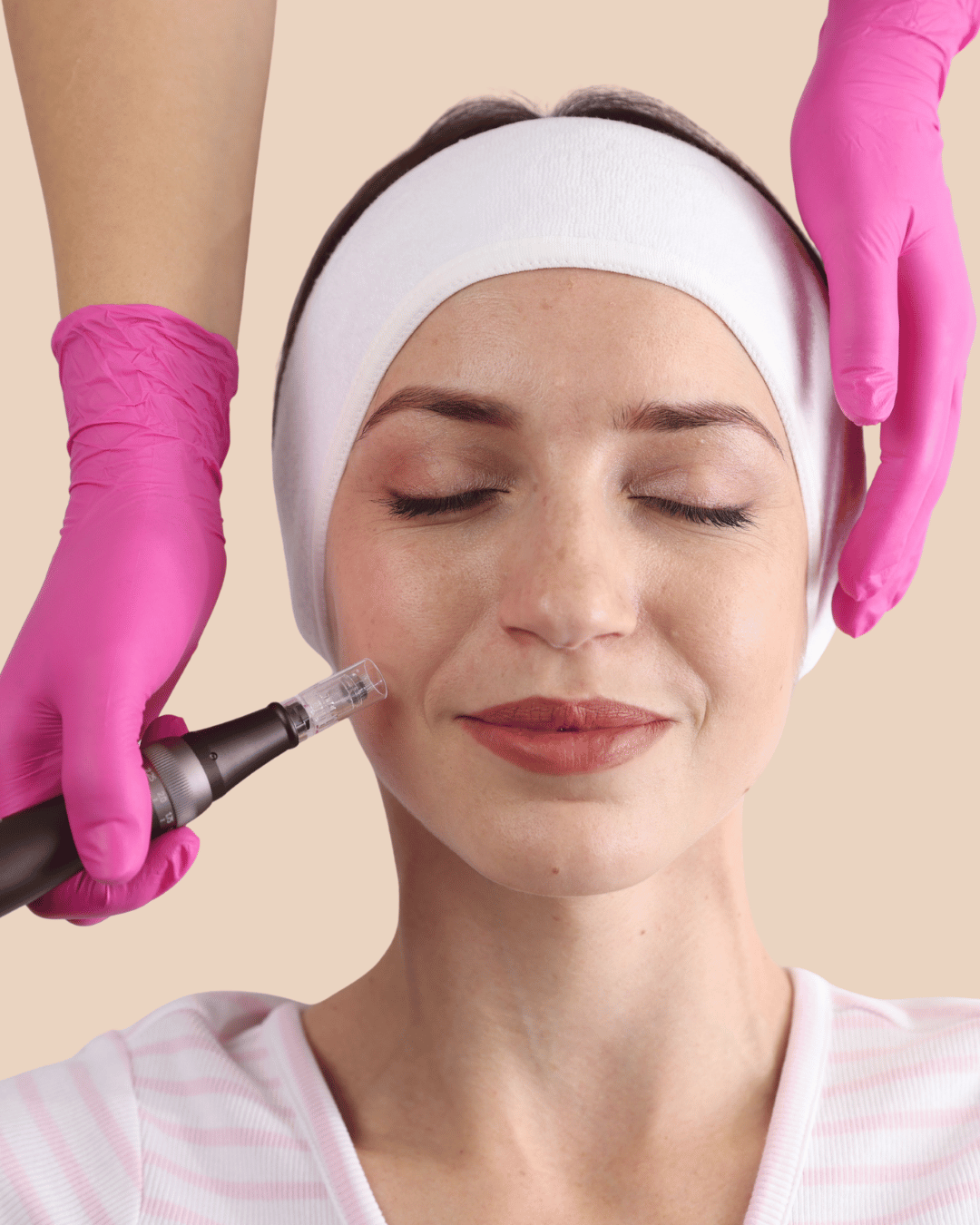 RF Microneedling Lebanon – Radiofrequency Facial Neck Rejuvenation Beirut
