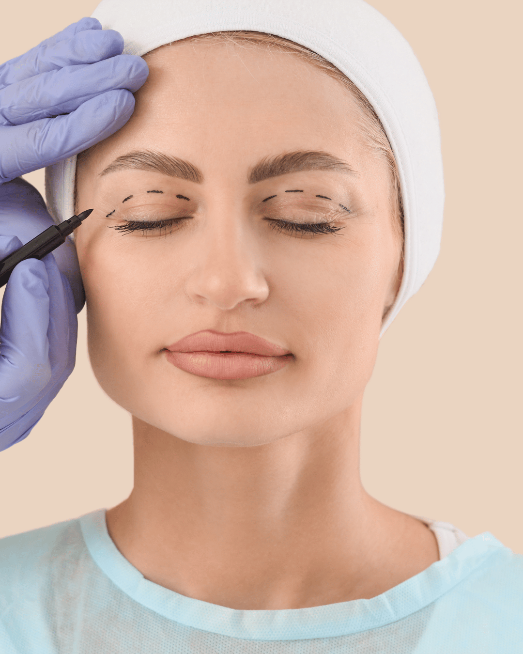 Upper Blepharoplasty Lebanon – Upper Eyelid Surgery Beirut at The Face Institute